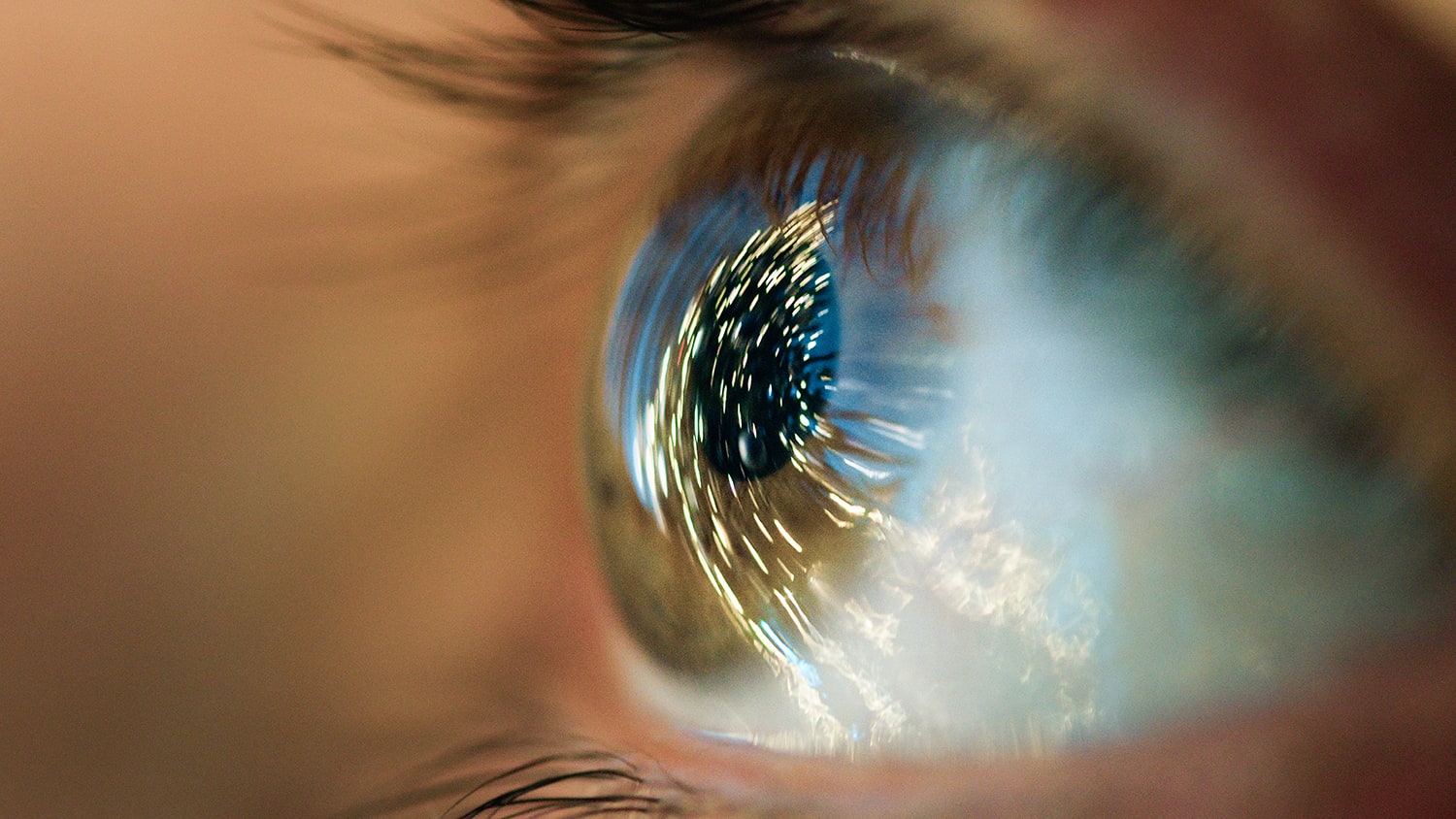 Why Cataract Patients Should Wear Hyperlight Optics®!